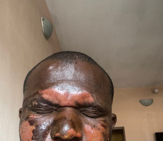 Religious Extremism: Scars, Pains, untold stories – The Ukpabi Solomon Onyinyechi Example